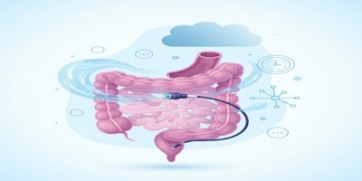 Colonoscopy Under Sedation: Advantages, Process and Curiosities of Colonoscopy Under Sedation