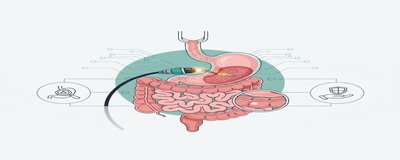Endoskopi Nedir? Nasıl Yapılır? Endoskopi Hakkında Bilmeniz Gerekenler