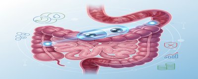Kapsül Endoskopi Nedir? Kapsül Endoskopi Nasıl Yapılır? (Hazırlık, Riskler, Sonuç ve Fiyatlar)