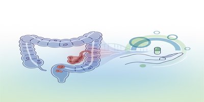 Kolon Kanseri Nedir? Kolon Kanseri Belirtileri ve Tedavisi