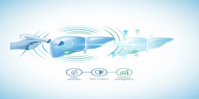 FibroScan Nedir? Karaciğer Fibrozis Ölçümü ve Avantajları