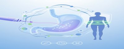 Mide Botoksu Nedir? Endoskopik Zayıflama İçin Mide Botoksu (Kimlere Uygun, Süreç, Riskler)